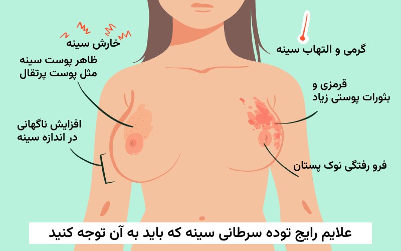 علایم توده سرطانی سینه