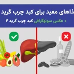 غذاهای مفید برای کبد چرب گرید 2